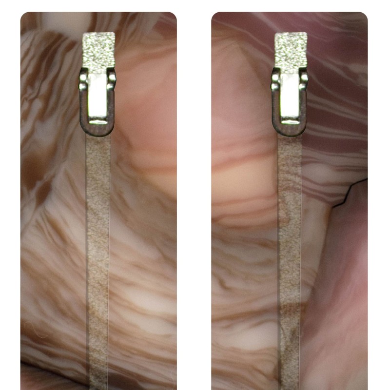 Pink Marble - 0008MA - Acetate temples